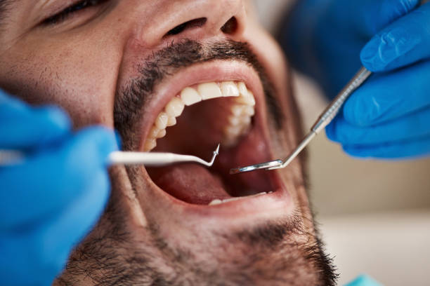 Best Emergency Dental Care for Abscessed Tooth in Hickman, NE